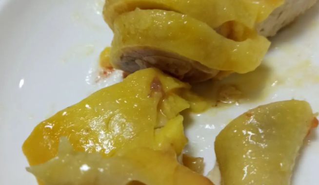 “甘油三酯大户”被米乐M6 M6米乐揪出医生：能不吃就不吃别等发病再后悔(图3)