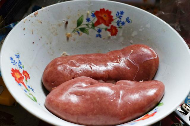 心血管主任：降脂很轻松1种零食尝试吃有助于减少血脂头米乐M6 M6米乐不晕(图4)